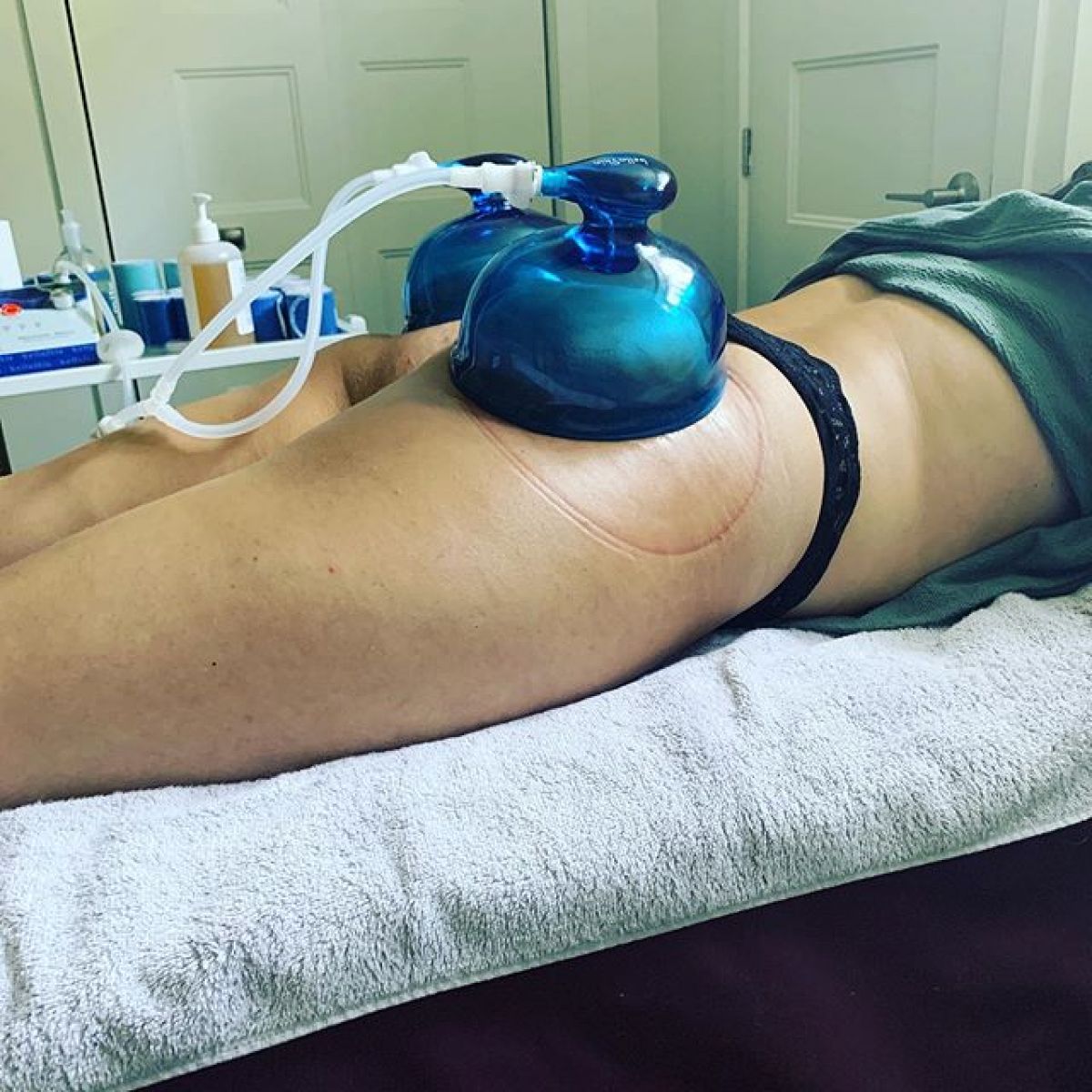 Lifting Colombien à Villeneuve-d'Ascq (59) Par Lucie - Estheca