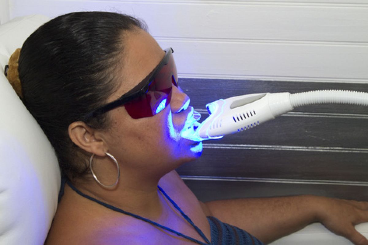 Blanchiment dentaire à Eckbolsheim (67) Par Morgane - Estheca
