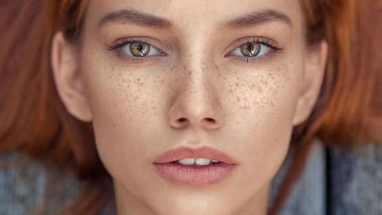 Tâches de rousseur / Grain de beauté  à Dijon (21) Par Cindy - Estheca