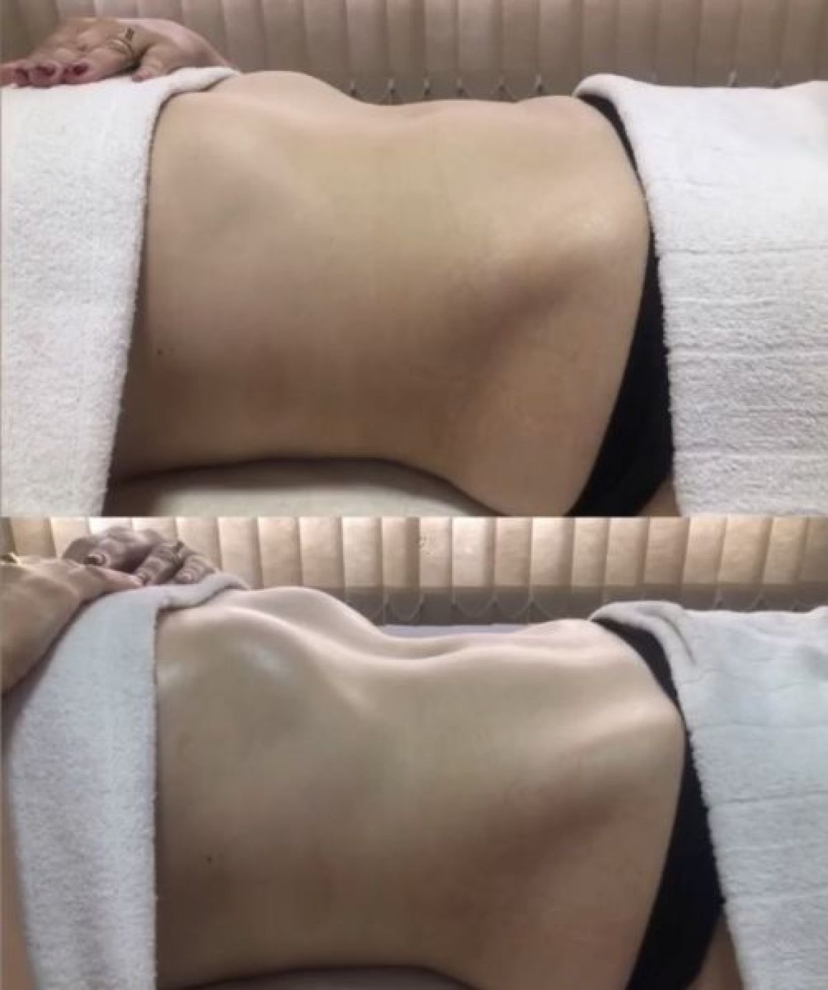 Drainage lymphatique Renata França à Belfort (90) Par Joyce - Estheca