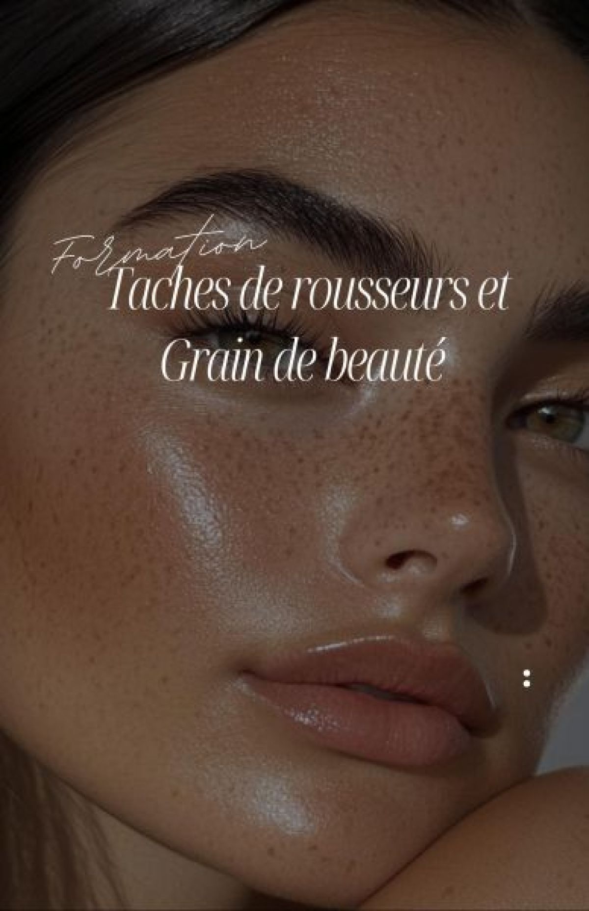Formation tâches de rousseur / Grain de beauté  à Noisy-le-Grand (93) Par Nassima - Estheca