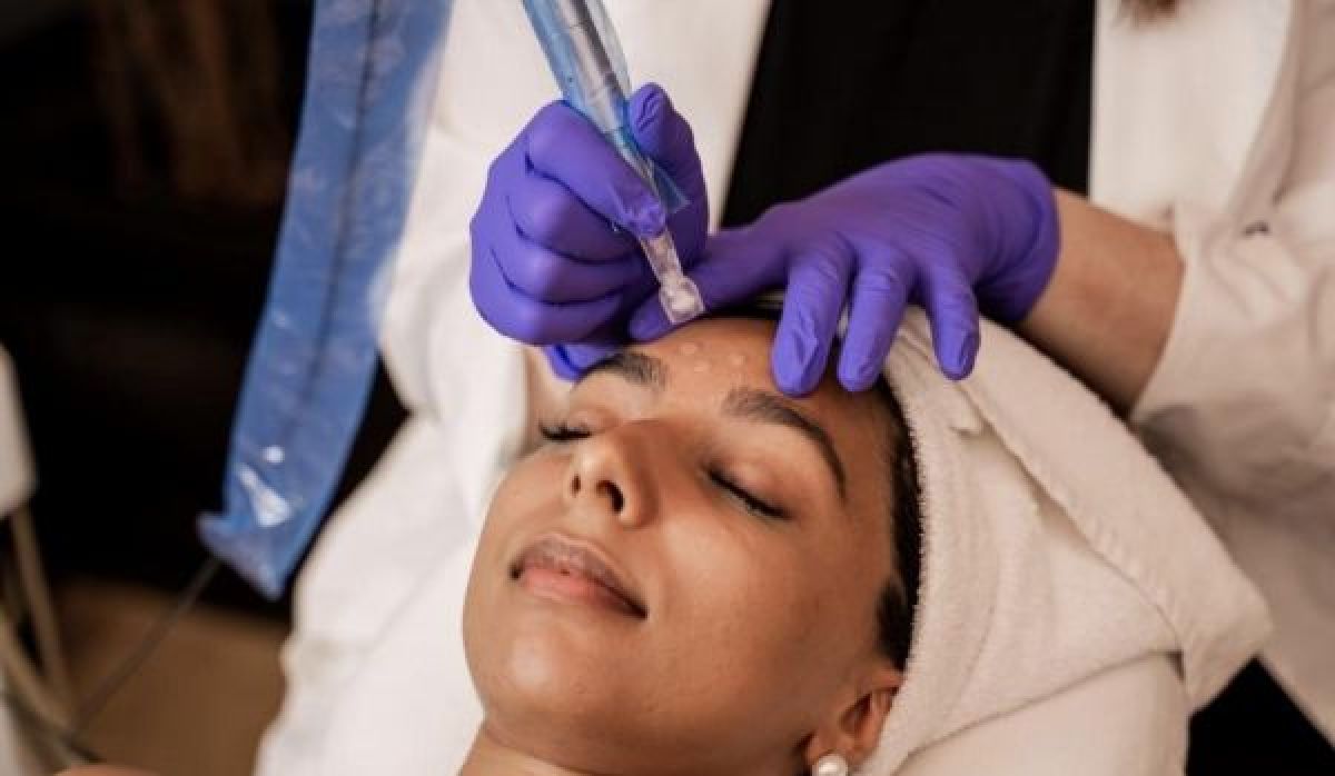 Microneedling(traces d'acnés, imperfections...) à Baie-Mahault (971) Par Lucy - Estheca