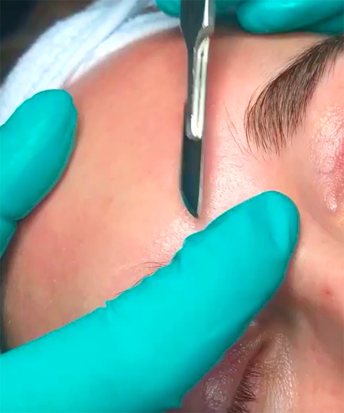 À Sens | Dermaplanning | Les meilleures esthéticiennes
