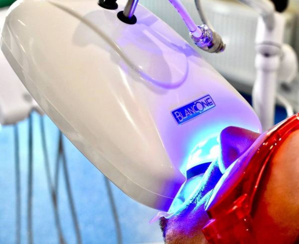 Blanchiment dentaire Pro à Sevran (93) Par Caroline - Estheca