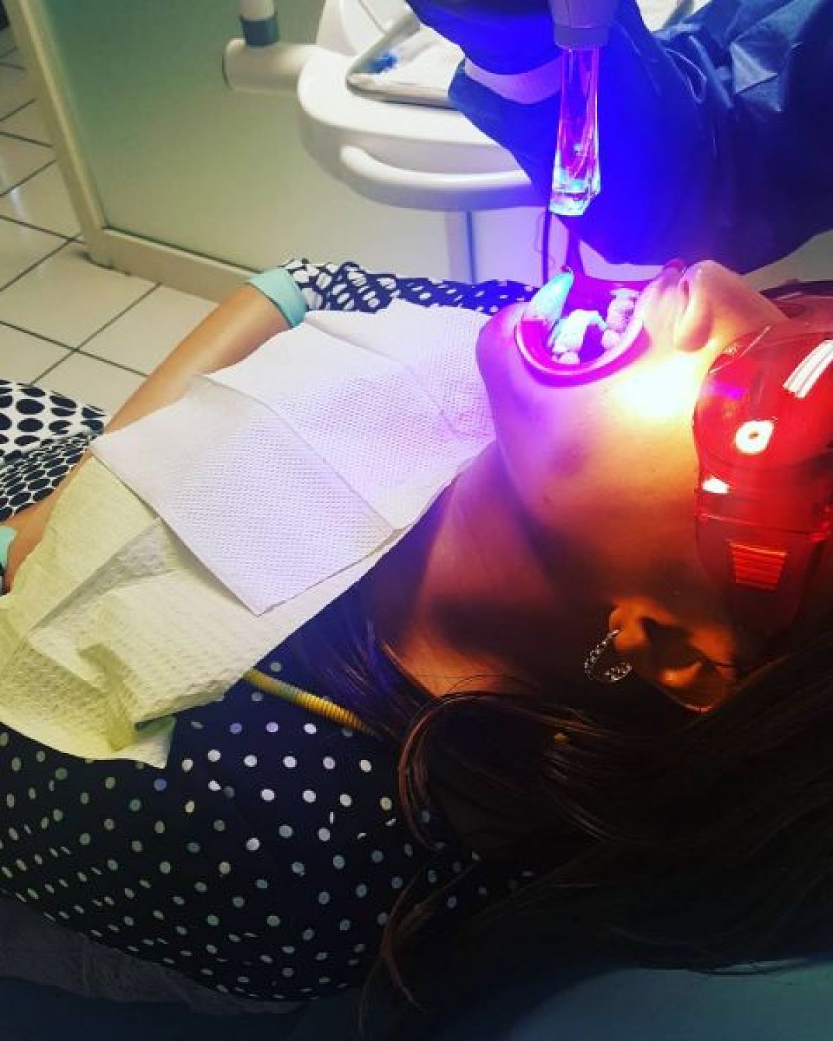 Blanchiment dentaire Pro à Cergy (95) Par Melinda - Estheca