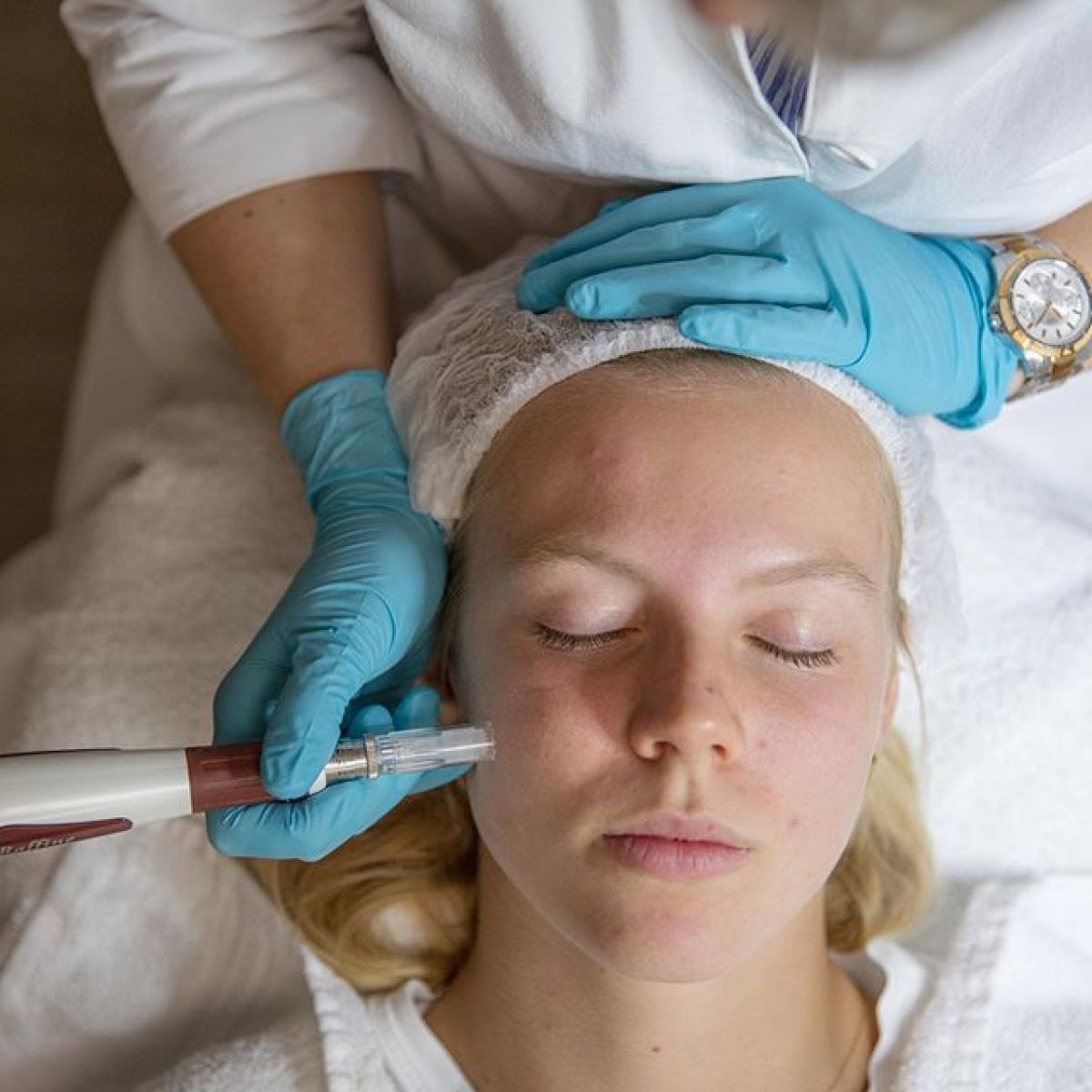 MicroNeedling BB Glow à Drancy (93) Par Anaïs - Estheca