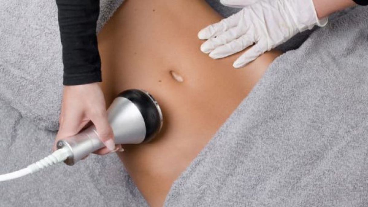 Radio fréquence et Lipocavitation à Reims (51) Par Inès - Estheca