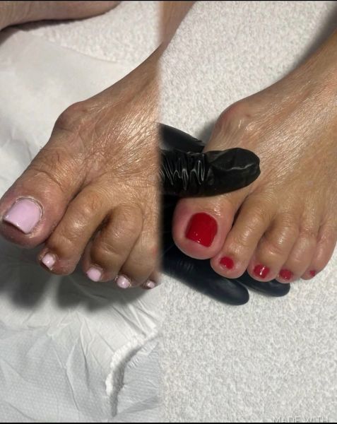 À Strasbourg | Pedicure russe | Les meilleures esthéticiennes