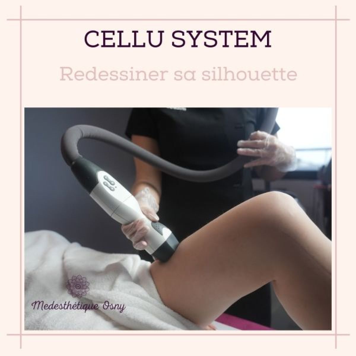 Radio Fréquence à Osny (95) Par Sabrina - Estheca