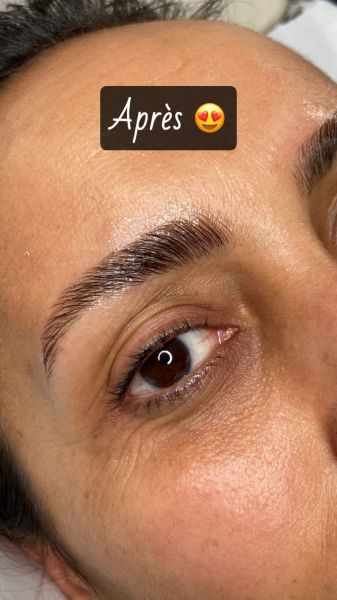 À Béziers | Browlift (rehaussement de sourcils) | Les meilleures esthéticiennes