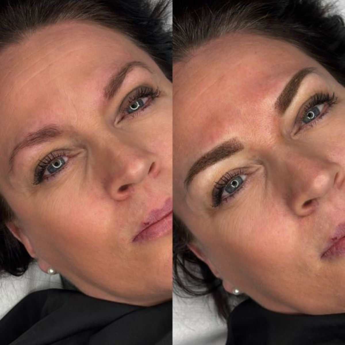 Microshading  à Fréjus (83) Par Julie - Estheca