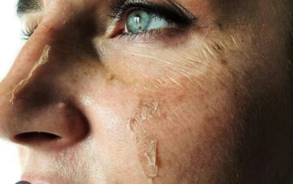 À Palaiseau | Peeling | Les meilleures esthéticiennes