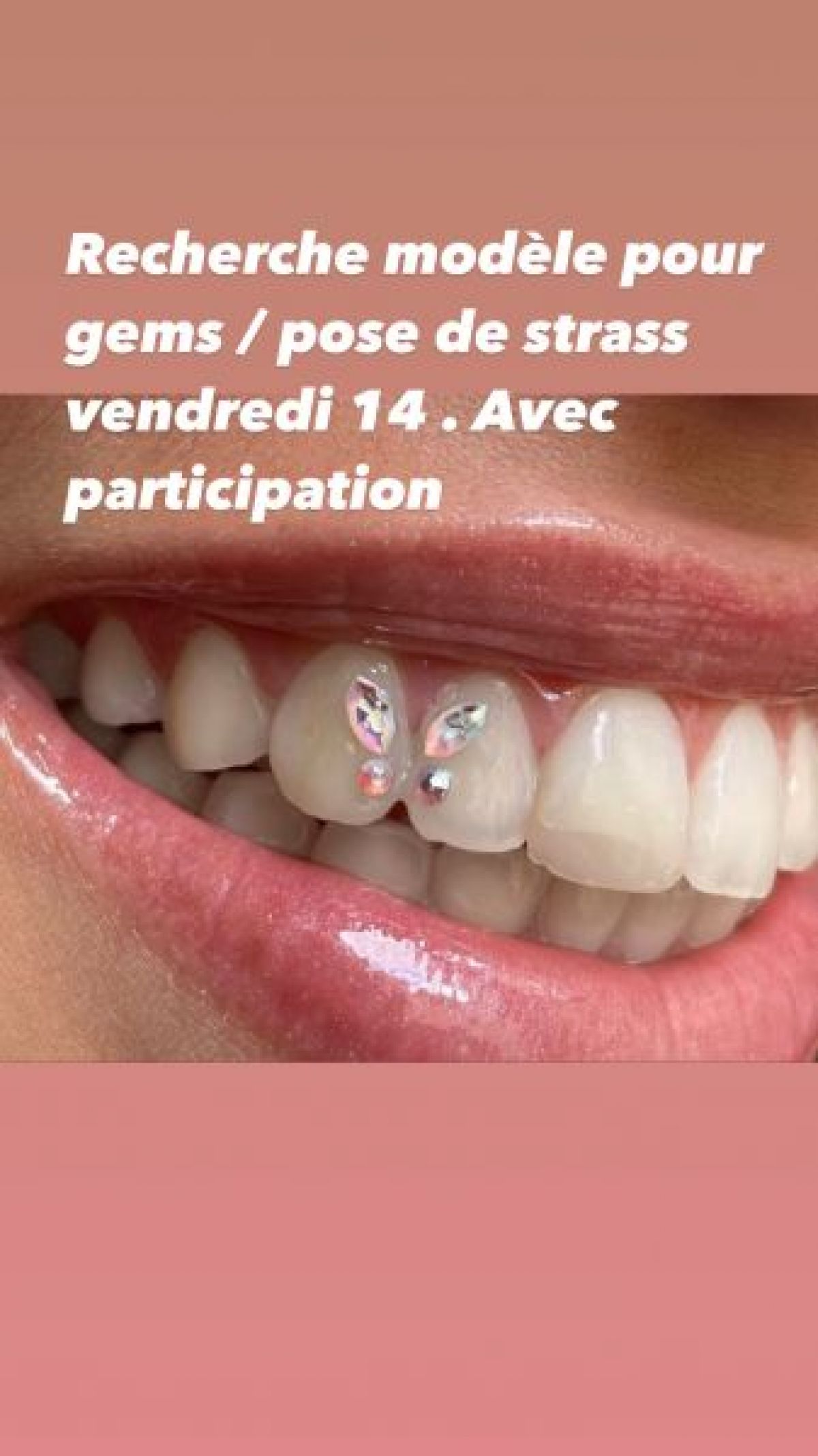 Pose de strass dentaire à Thionville (57) Par Soraya - Estheca