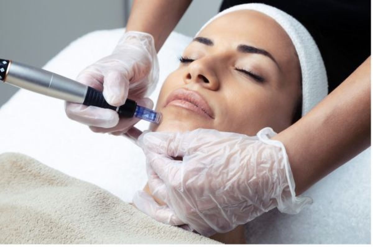 Microneedling BB GLOW à Saint-Louis (68) Par Sanae - Estheca