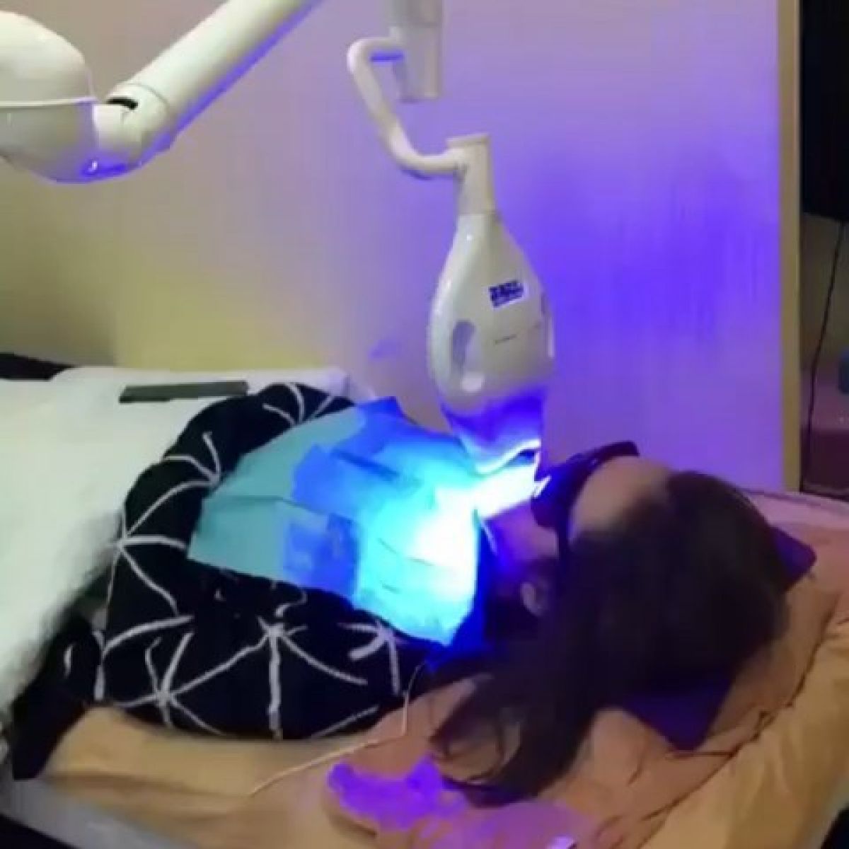 Blanchiment dentaire Professionnel à Antibes (06) Par Samantha - Estheca