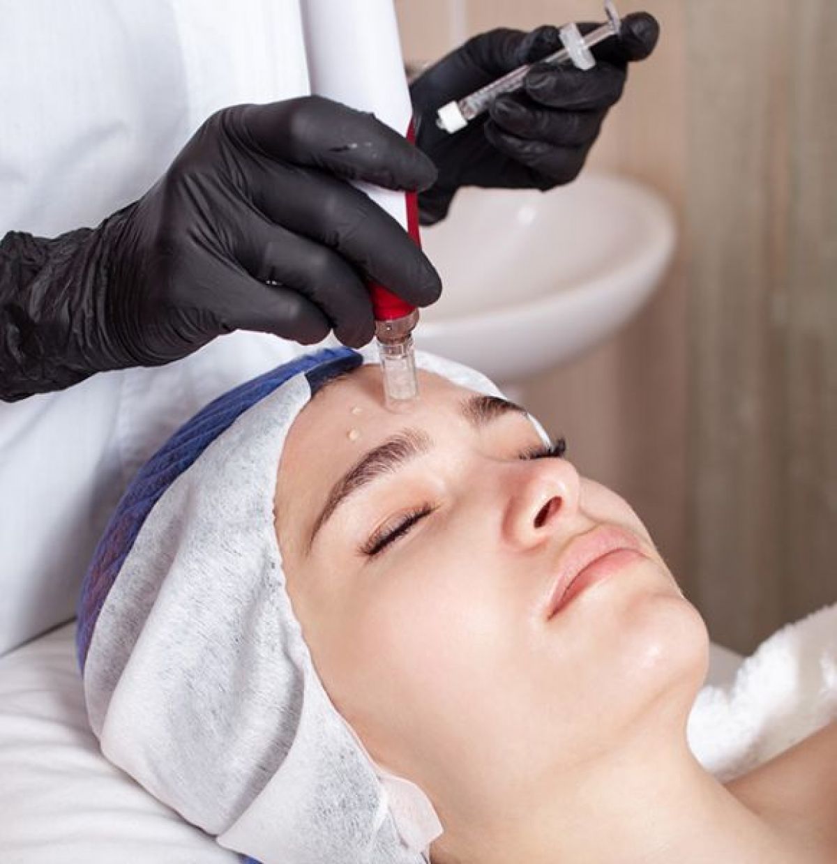Microneedling à Claye-Souilly (77) Par Zahra - Estheca