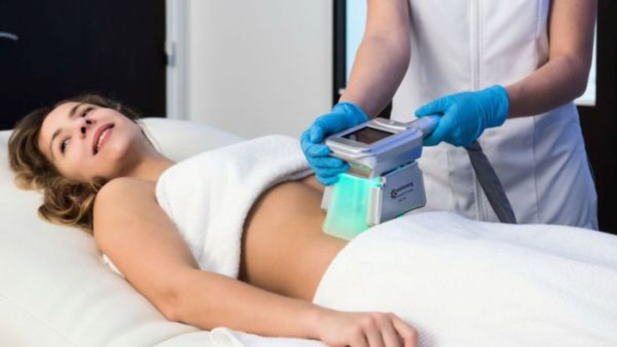 Cryolipolyse à Paris (75) Par Wendy - Estheca