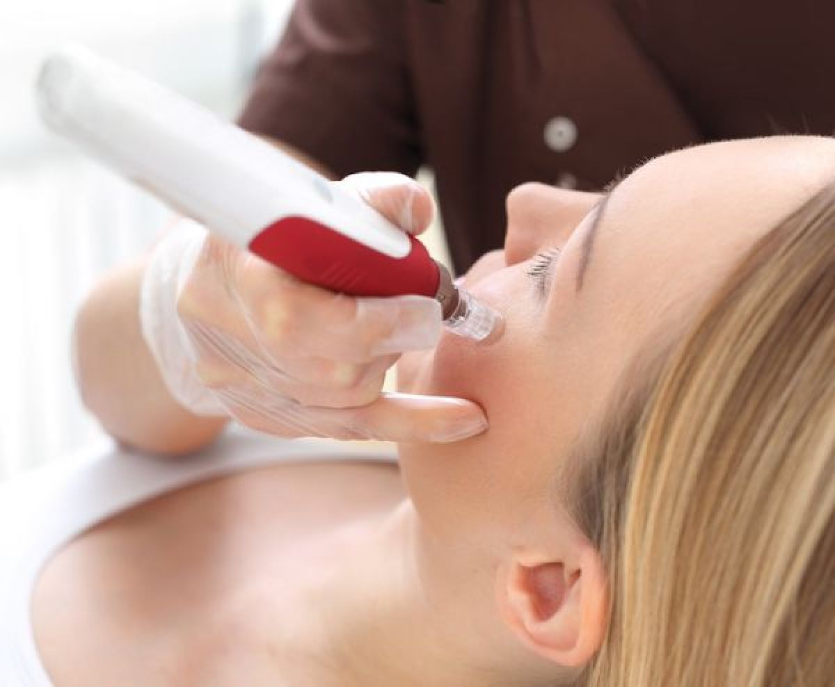 Microneedling BB GLOW à Nantes (44) Par Margot - Estheca