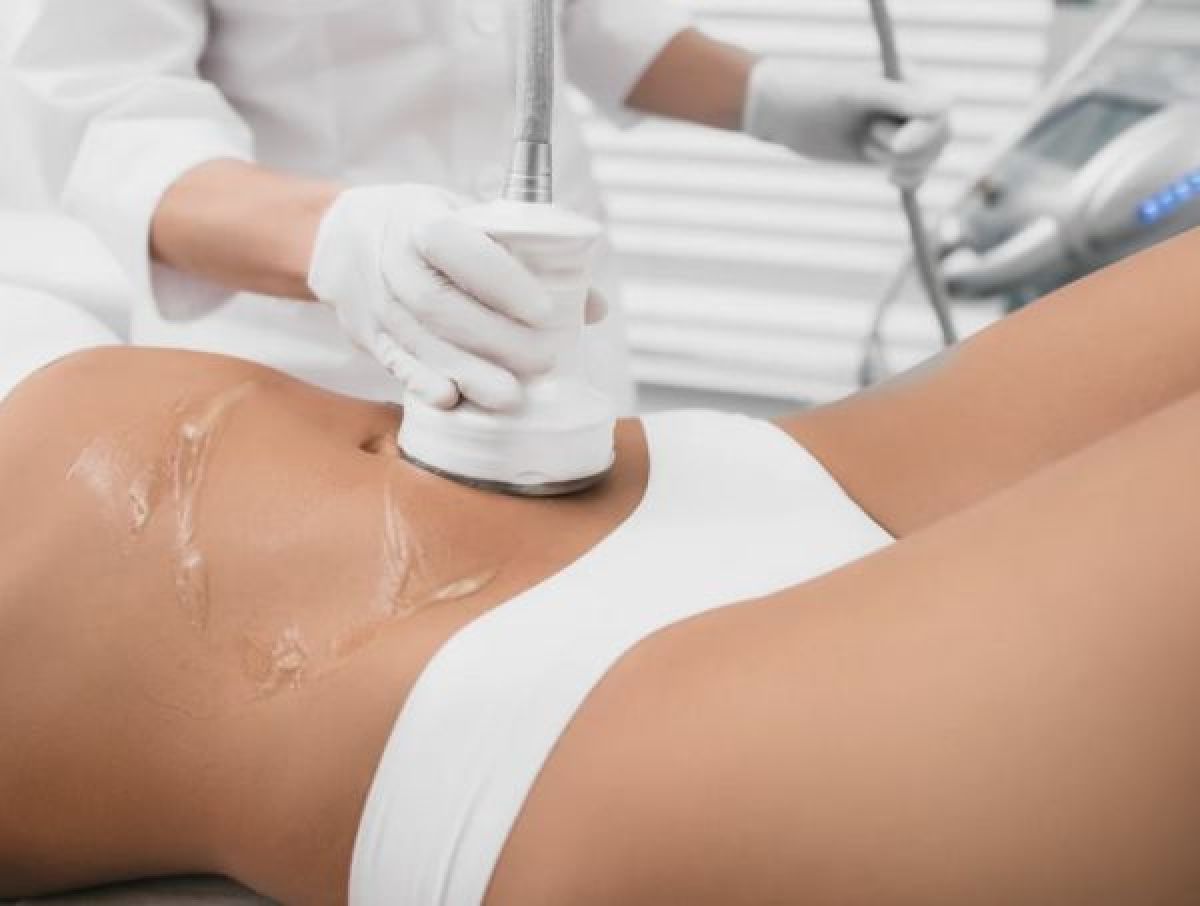 BODY SCULPT Lipocavitation & Radiofréquence à Marseille (13) Par Camelia - Estheca