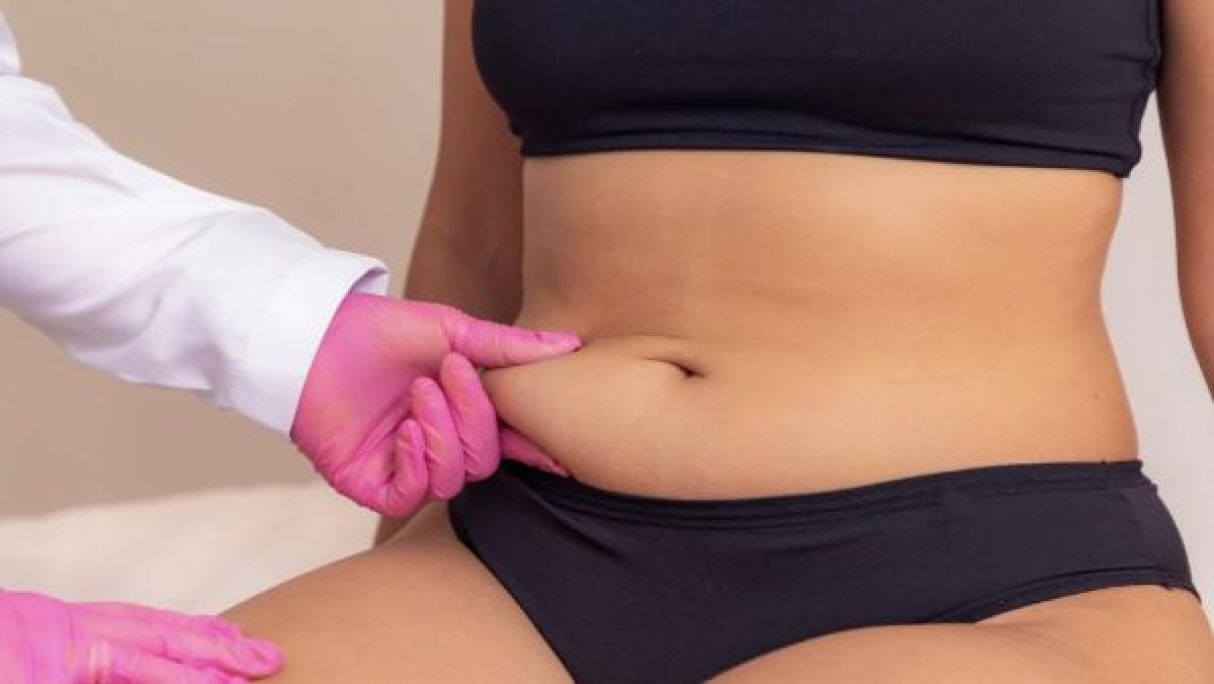 Lifting du ventre à Pfastatt (68) Par Doha - Estheca