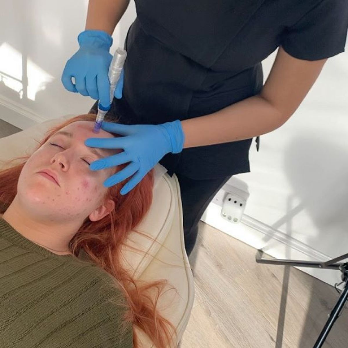 MicroNeedling BB Glow à Moissy-Cramayel (77) Par Cécile - Estheca