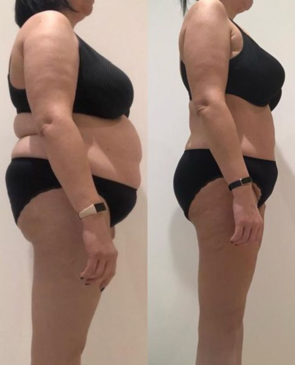 Drainage lymphatique à Asnières-sur-Seine (92) Par Samantha - Estheca