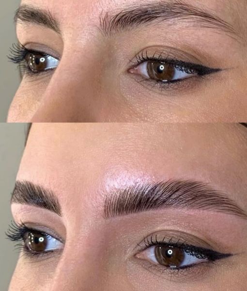À Choisy-le-Roi | Browlift (rehaussement de sourcils) | Les meilleures esthéticiennes