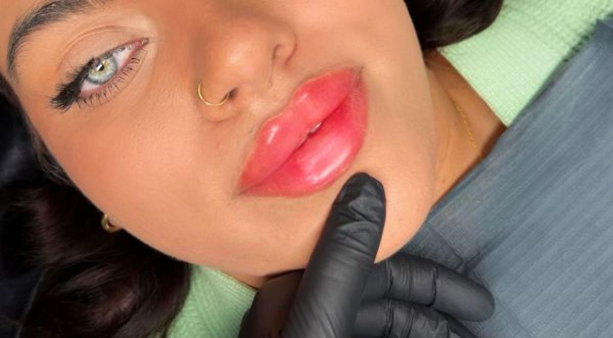 Augmentation des lèvres sans injection à Combs-la-Ville (77) Par Mariette - Estheca
