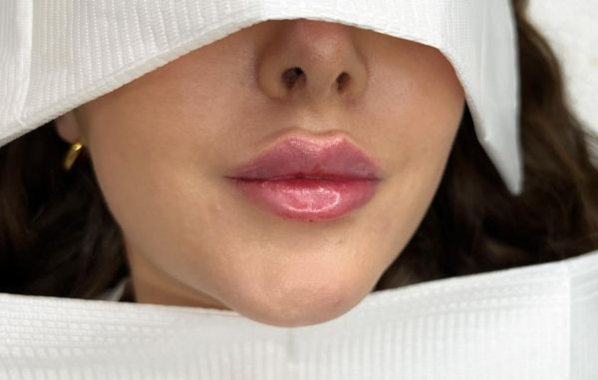Russian lips / Glow lips à Romagnat (63) Par Déborah - Estheca