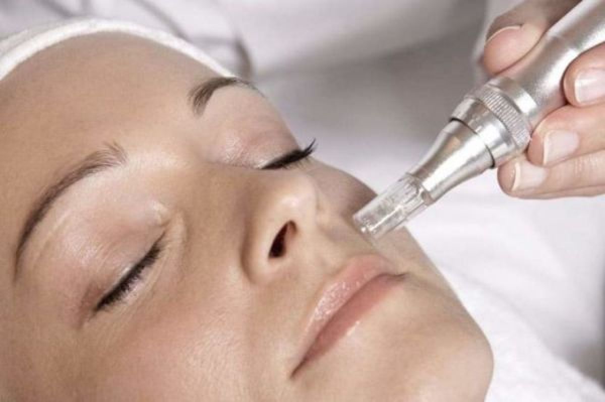 MicroNeedling BB Glow à Geispolsheim (67) Par Célia - Estheca