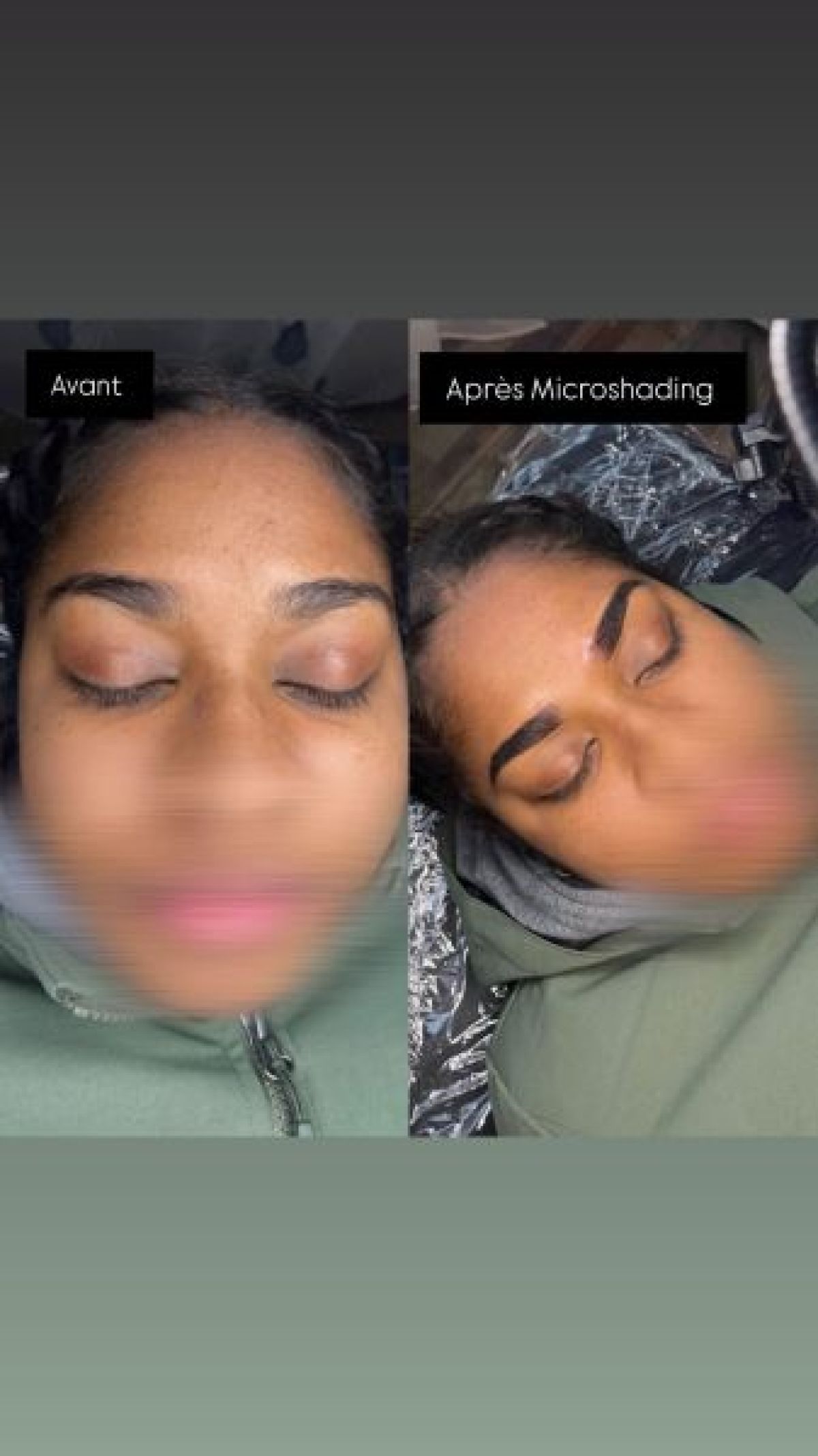 Microshading à Neuilly-sur-Marne (93) Par Myriam - Estheca