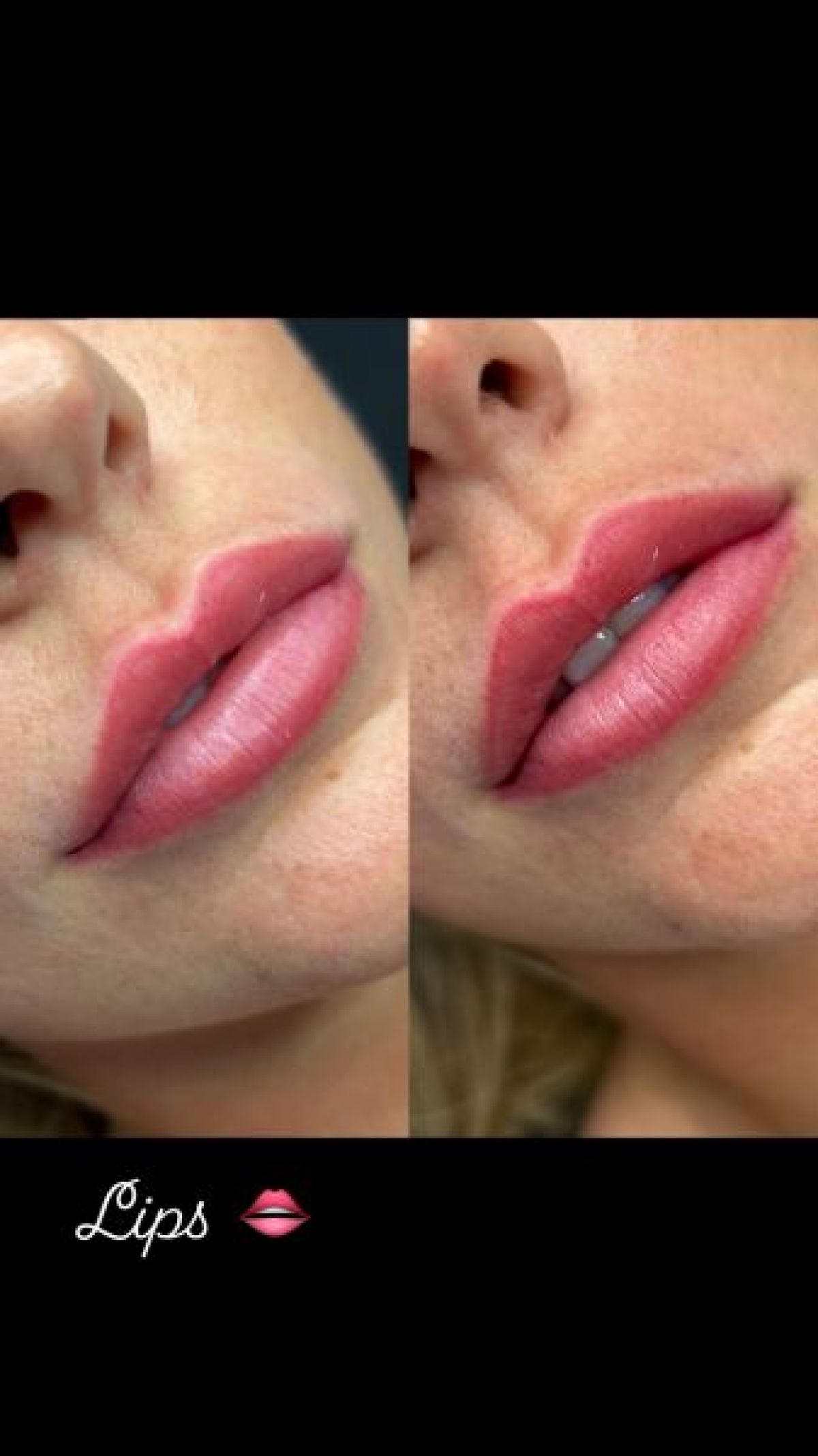 Maquillage permanent (full lips) à Brie-Comte-Robert (77) Par Egzona - Estheca