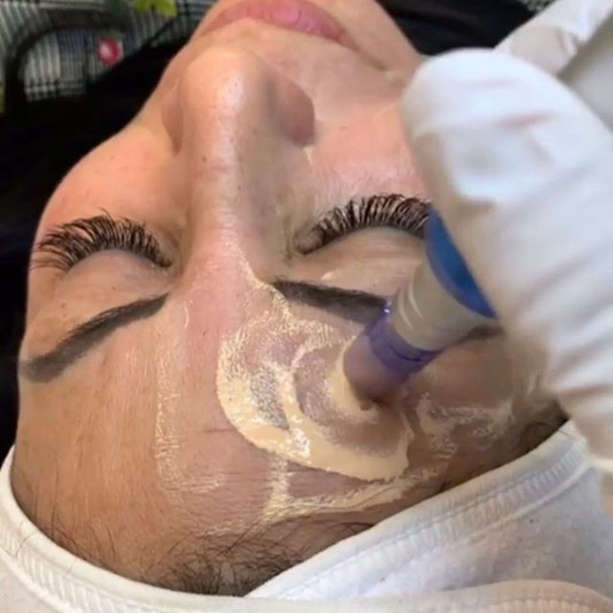 MicroNeedling BB Glow à Sartrouville (78) Par Léa - Estheca