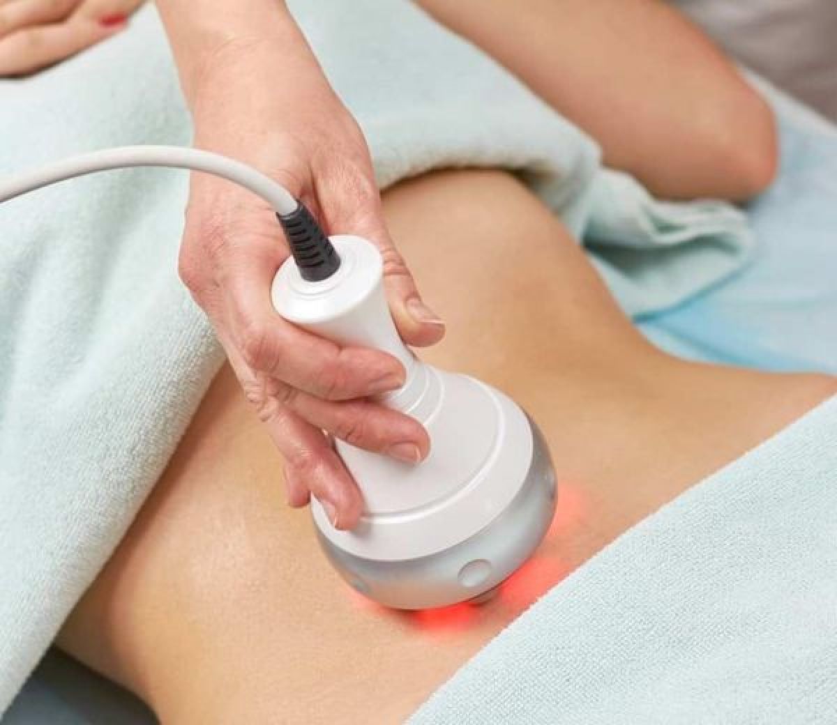 Radio fréquence et Lipocavitation à Vénissieux (69) Par Chloé - Estheca