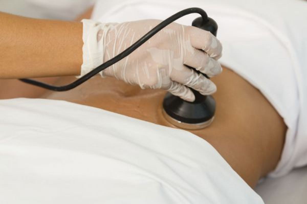 Lipocavitation - Radiofréquence à Corbeil-Essonnes (91) Par Safia - Estheca