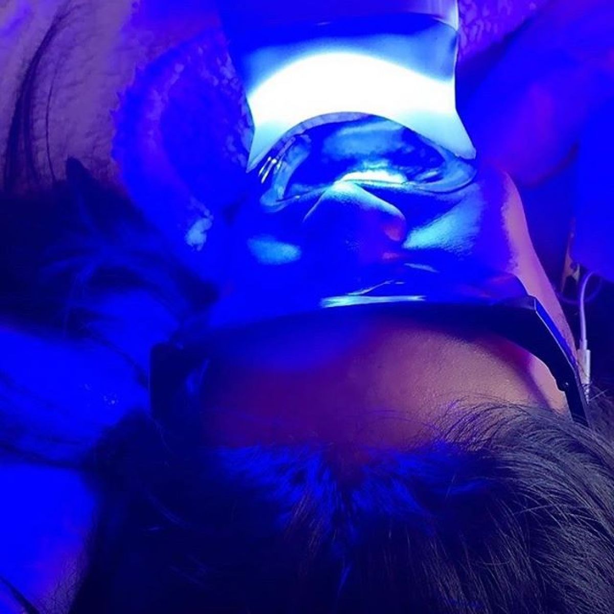 Blanchiment dentaire Pro à Boulogne-Billancourt (92) Par Vanessa - Estheca
