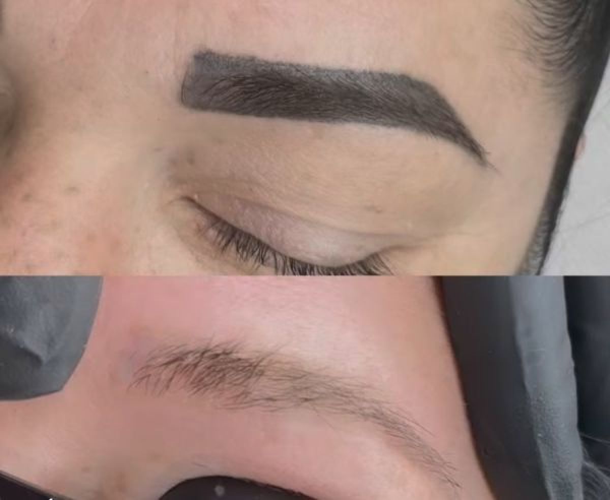 Speed detatouage à Saint-Leu-la-Forêt (95) Par Kelly - Estheca