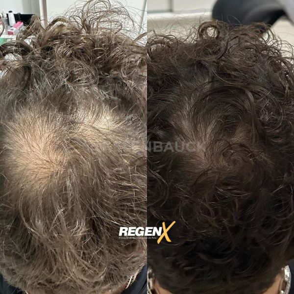 À Nîmes | Regenx | Les meilleures esthéticiennes