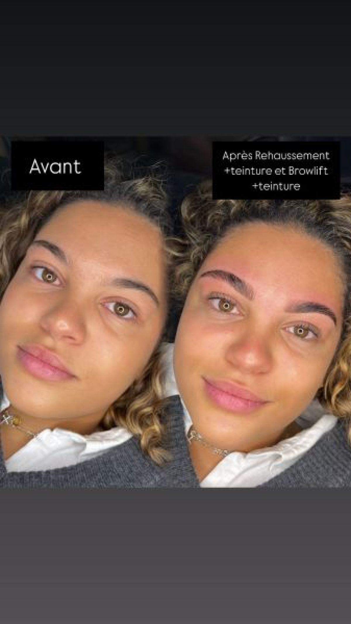 Browlift (rehaussement de sourcils) à Neuilly-sur-Marne (93) Par Myriam - Estheca