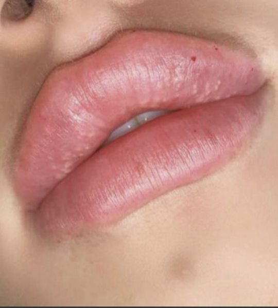 À Palaiseau | Russian lips | Les meilleures esthéticiennes