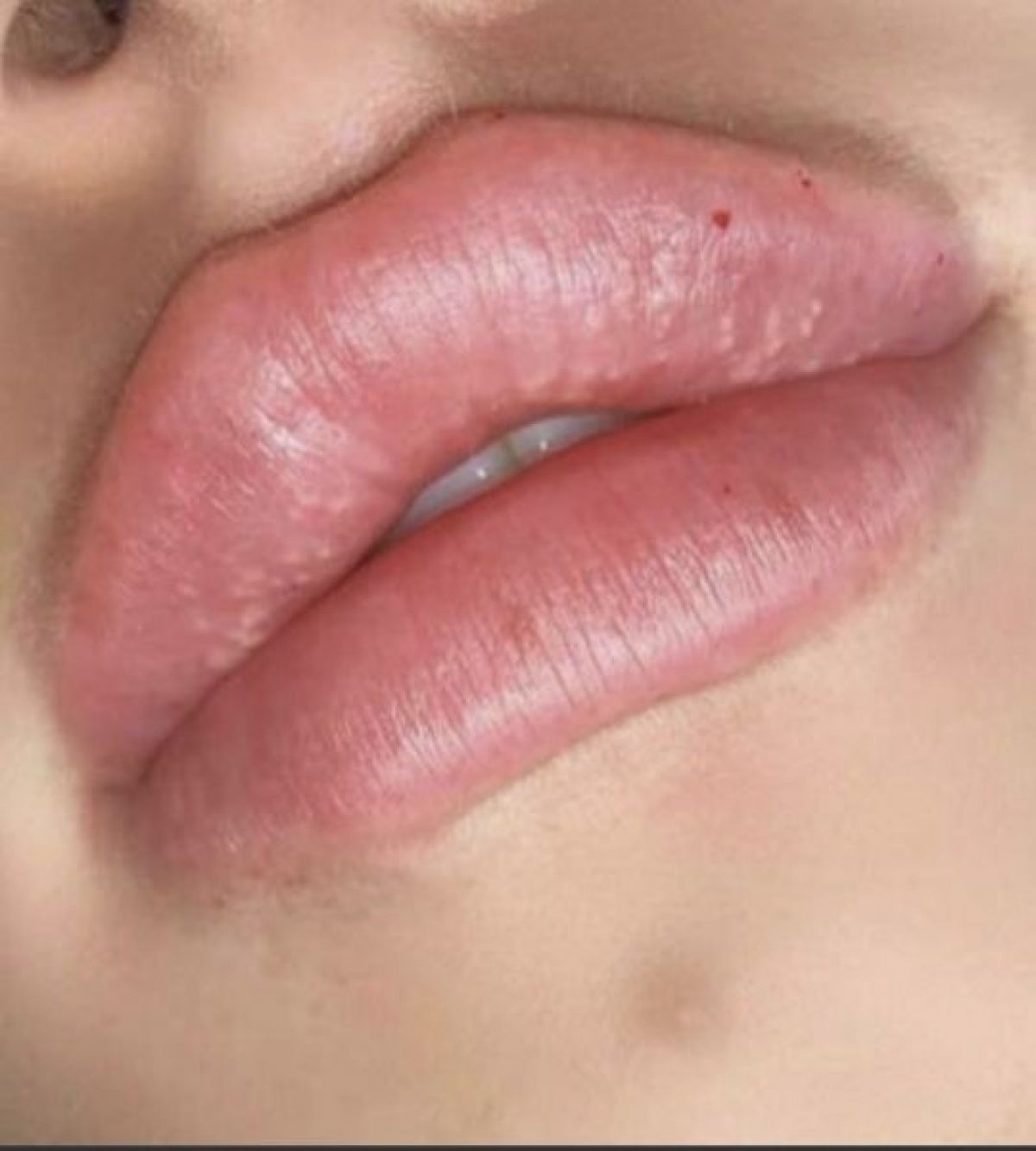 Russian lips à Palaiseau (91) Par Bouchra - Estheca