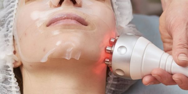 À Nantes | Radiofréquence visage/cou décolleté  | Les meilleures esthéticiennes