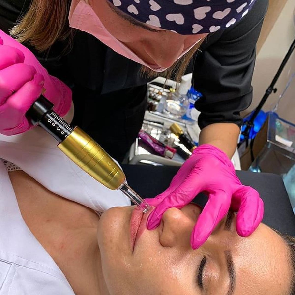 Hyaluron pen Lèvres à Saint-Maur-des-Fossés (94) Par Céline - Estheca
