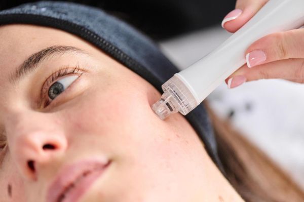 À Lens | Microneedling/NANO                                  | Les meilleures esthéticiennes