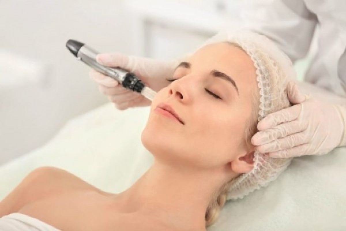 Microneedling BB GLOW à Strasbourg (67) Par Sabrine - Estheca