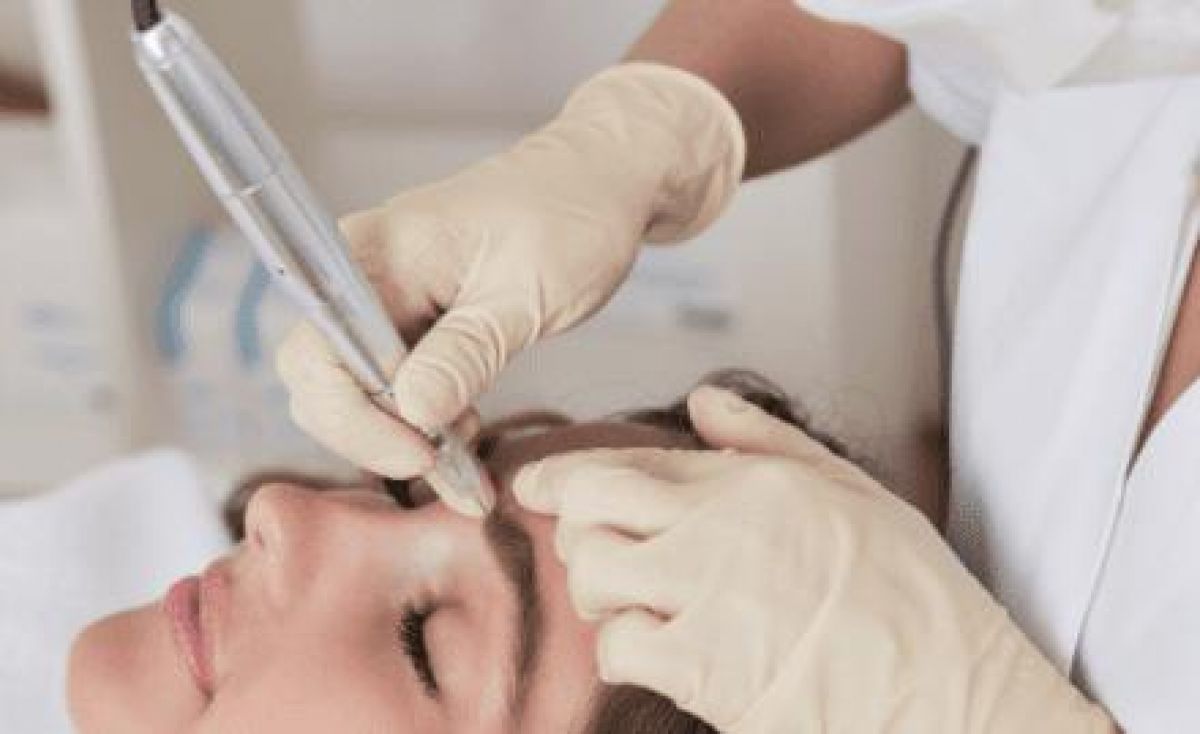 Détatouage sans laser à Morsang-sur-Orge (91) Par Charlène - Estheca