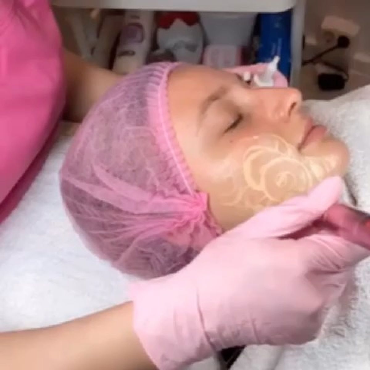 MicroNeedling BB Glow à Migné-Auxances (86) Par Audrey - Estheca