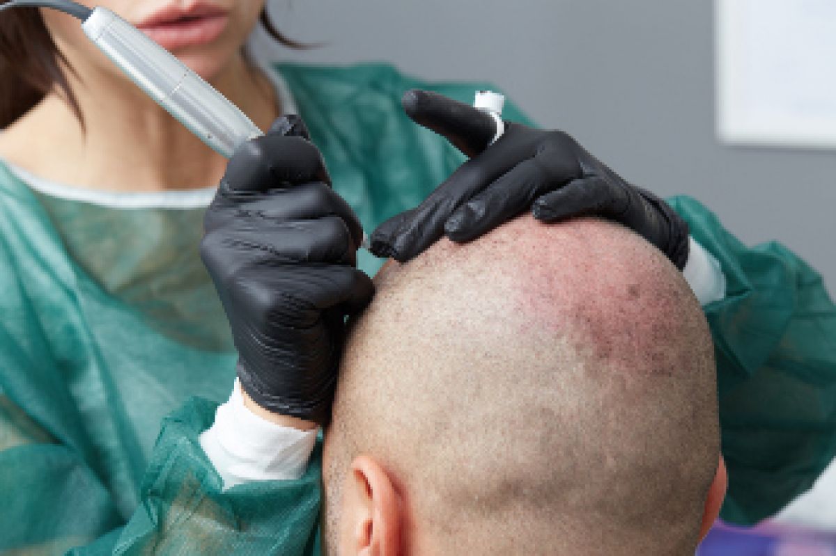 Formation tricopigmentation à Limoges (87) Par Gaëlle - Estheca