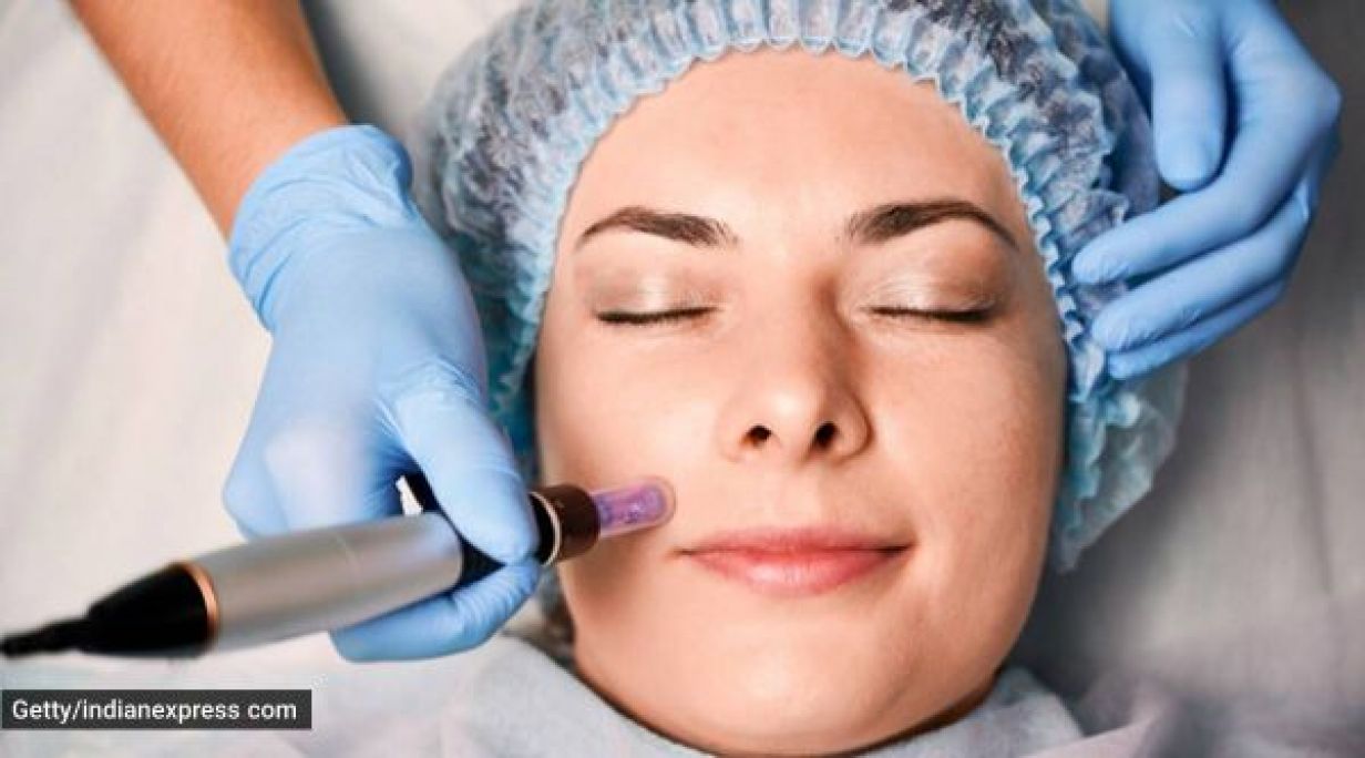 Microneedling(traces d'acnés, imperfections...) à Nanterre (92) Par Linda - Estheca