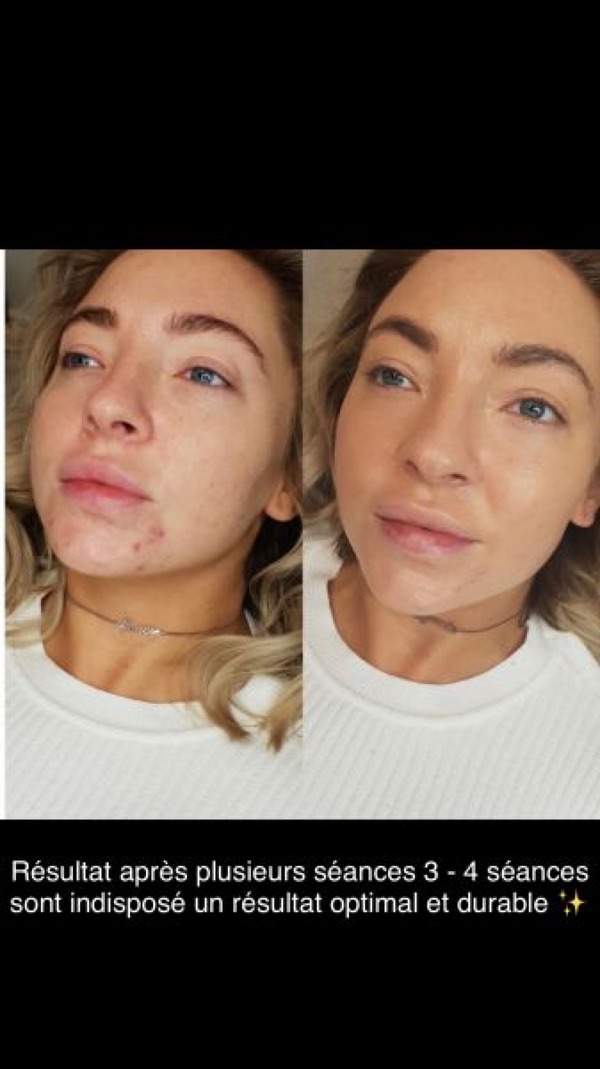  BB GLOW à Corbeil-Essonnes (91) Par Rachel - Estheca